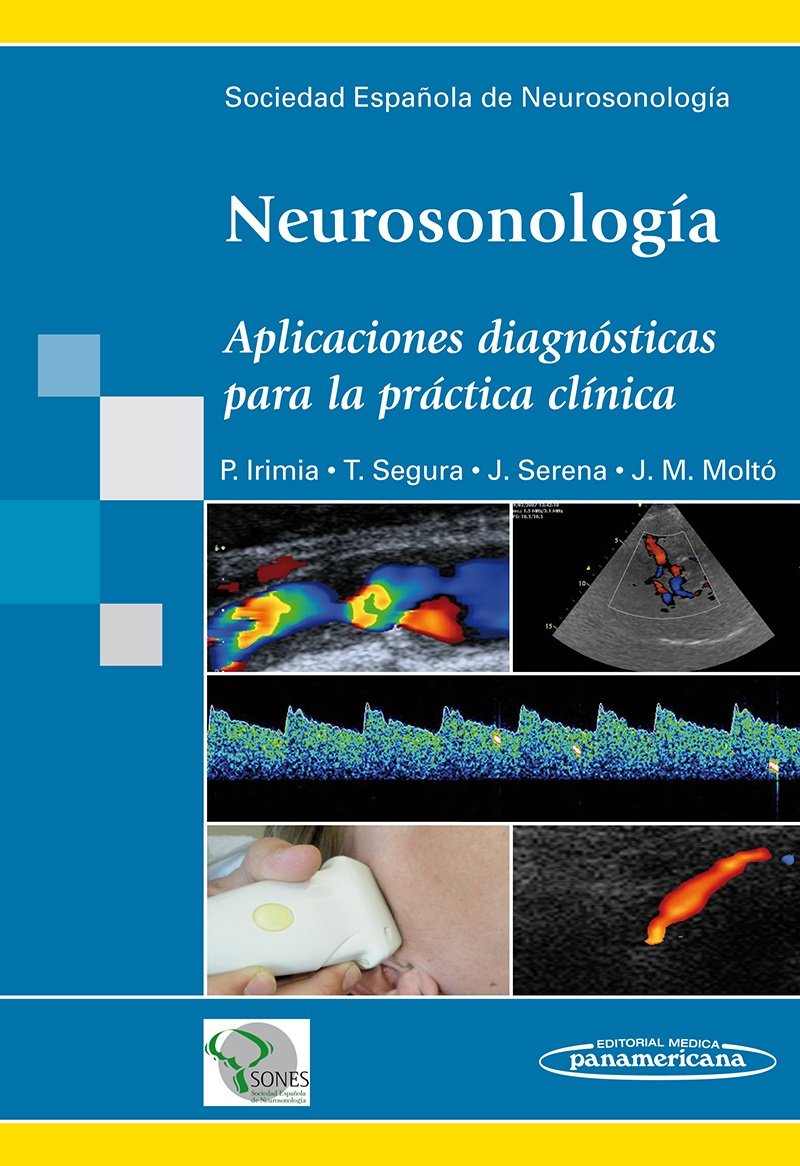 Neurosonología: Aplicaciones diagnósticas para la práctica clínica