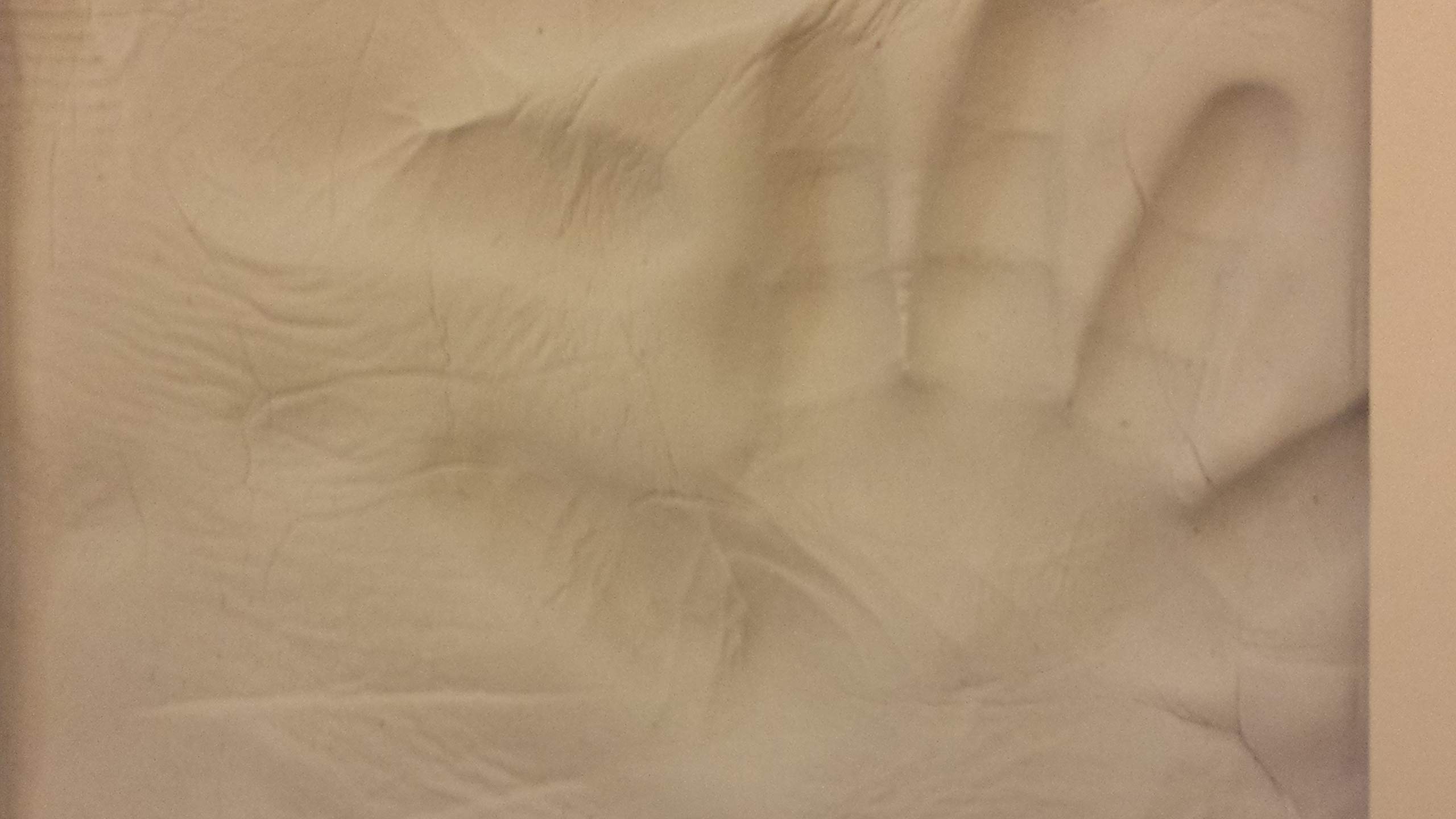 Mandoline Slicer, Vegetable Potato Slicer, Julienne Slicer, Onion Cutter, With Stainless Steel Blade By Medove.