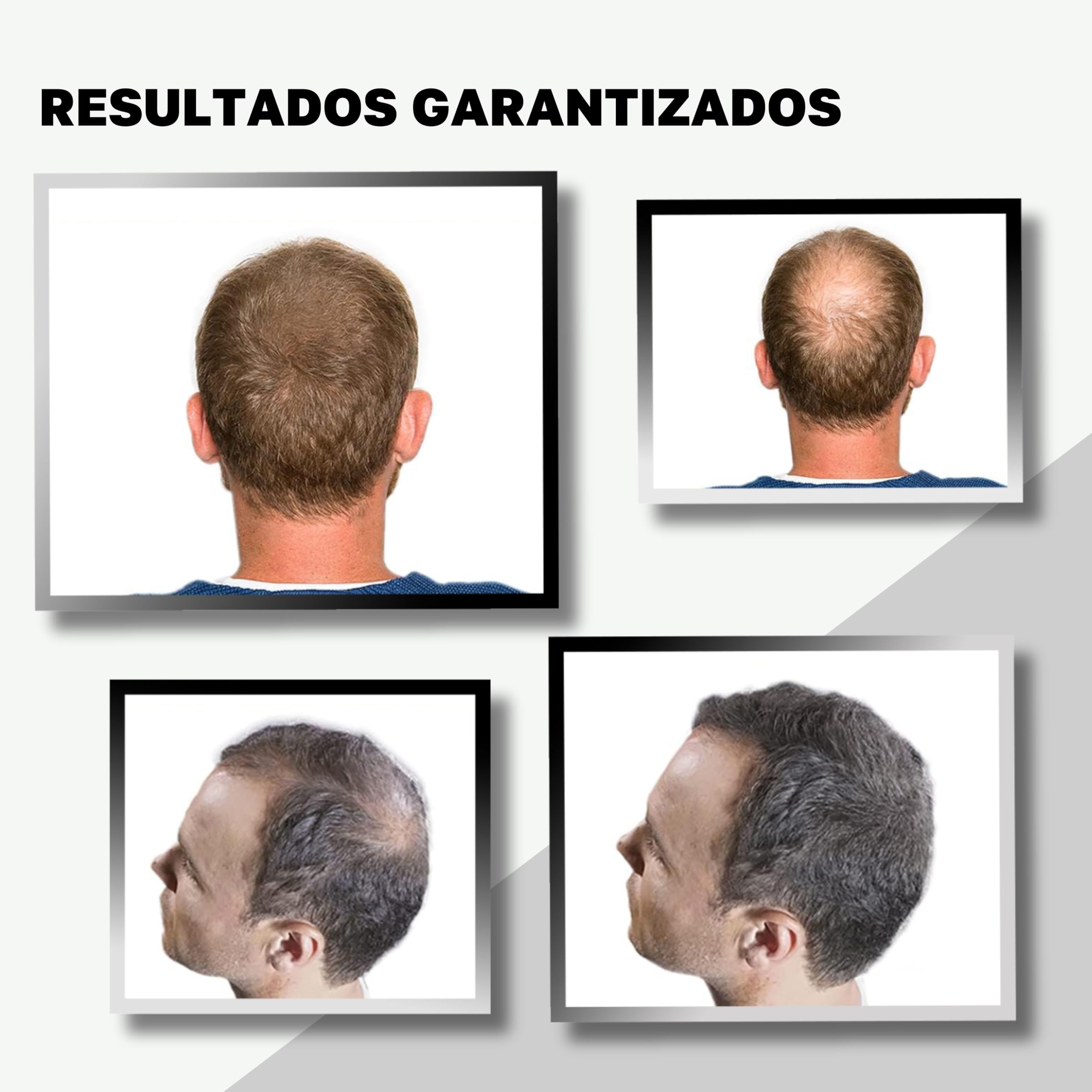 VidalForce Fibra Capilar Negro 60g (Pack 2x30g) 100% de origen Vegetal I Maquillaje Capilar indetectable I Fibras Keratina vegetal I Disimular Calvicie hombre y mujer