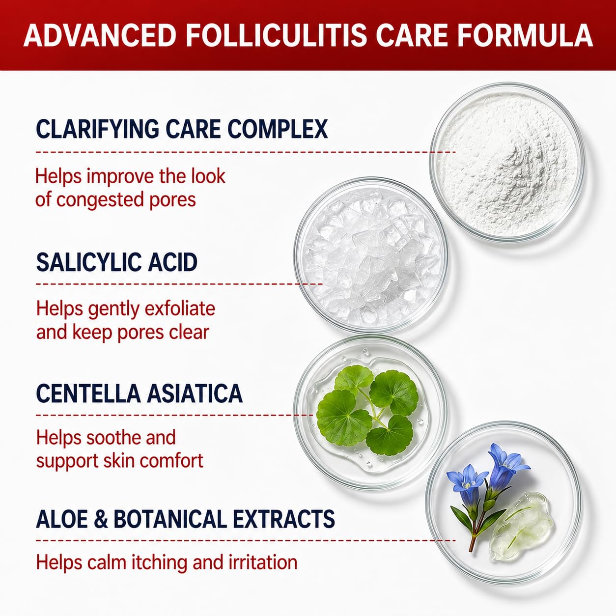 Folliculitis Treatment Cream with 5% Benzoyl Peroxide | Tea Tree Oil, Fast-Absorbing Razor Bump Cream for Ingrown Hairs, Bikini Line, Underarms, Legs & Body Bumps, 3.53 Fl Oz