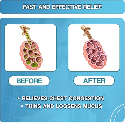 Miniatura 3 de Safrel Pharma - Guaifenesina para aliviar el moco, 400 mg - Expectorante de acción rápida, adelgaza y afloja el moco, alivia la congestión del