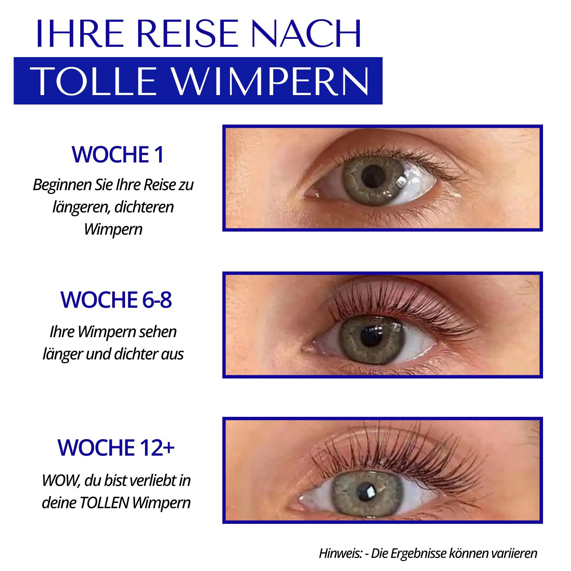 SPECTACULASH WIMPERNSERUM HORMONFREI XL - Leistungsstarkes Wimpernserum mit Peptidformel für Natürlich Längere und Vollere Wimpern - Lash Serum Wimpern Serum Wachstum Testsieger 8ML von DERMAWORK