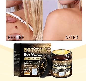 フェイスクリーム pom 薬用ニードルクリーム / 京薬粧(フェイスクリーム, スキンケア