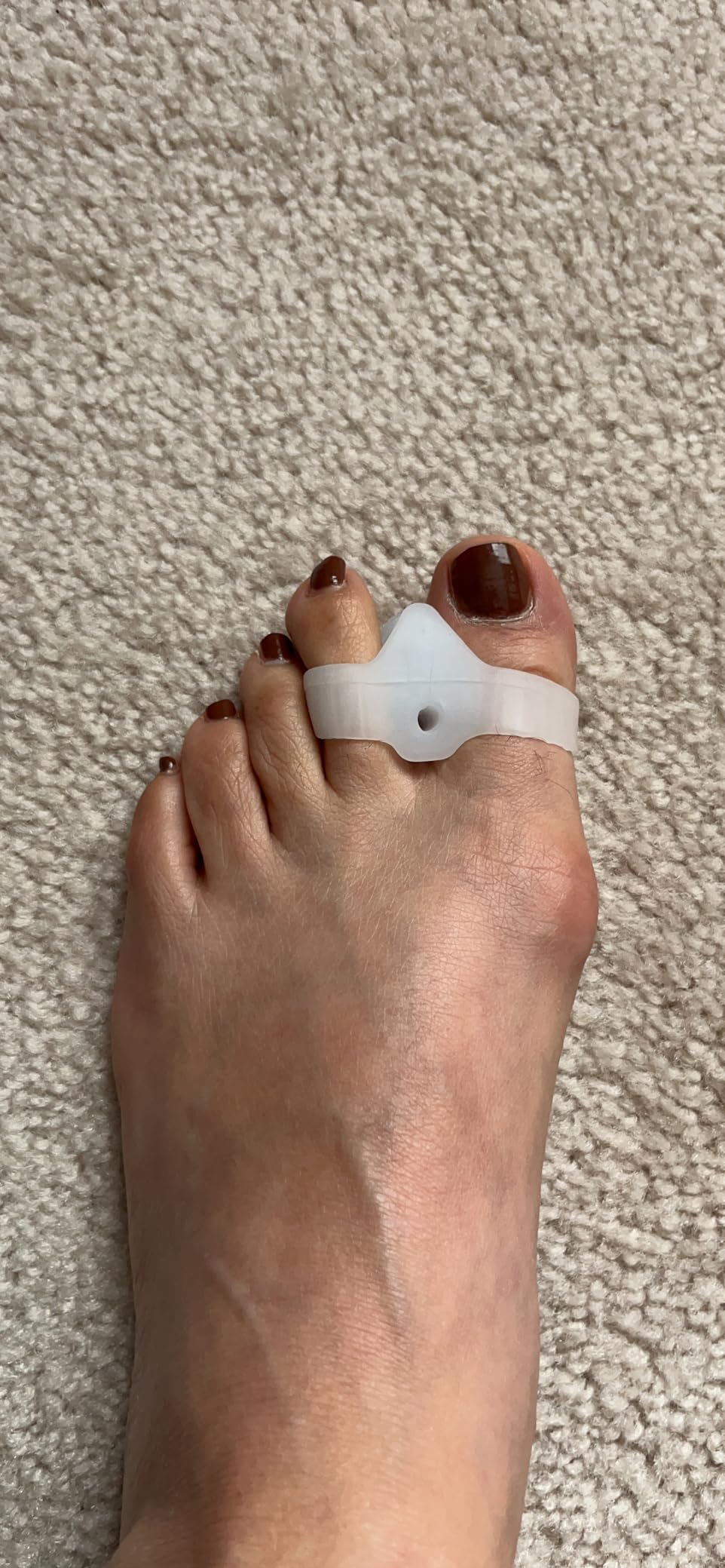 Vicorrect Bunion Corrector for Women and Men Orthopedic