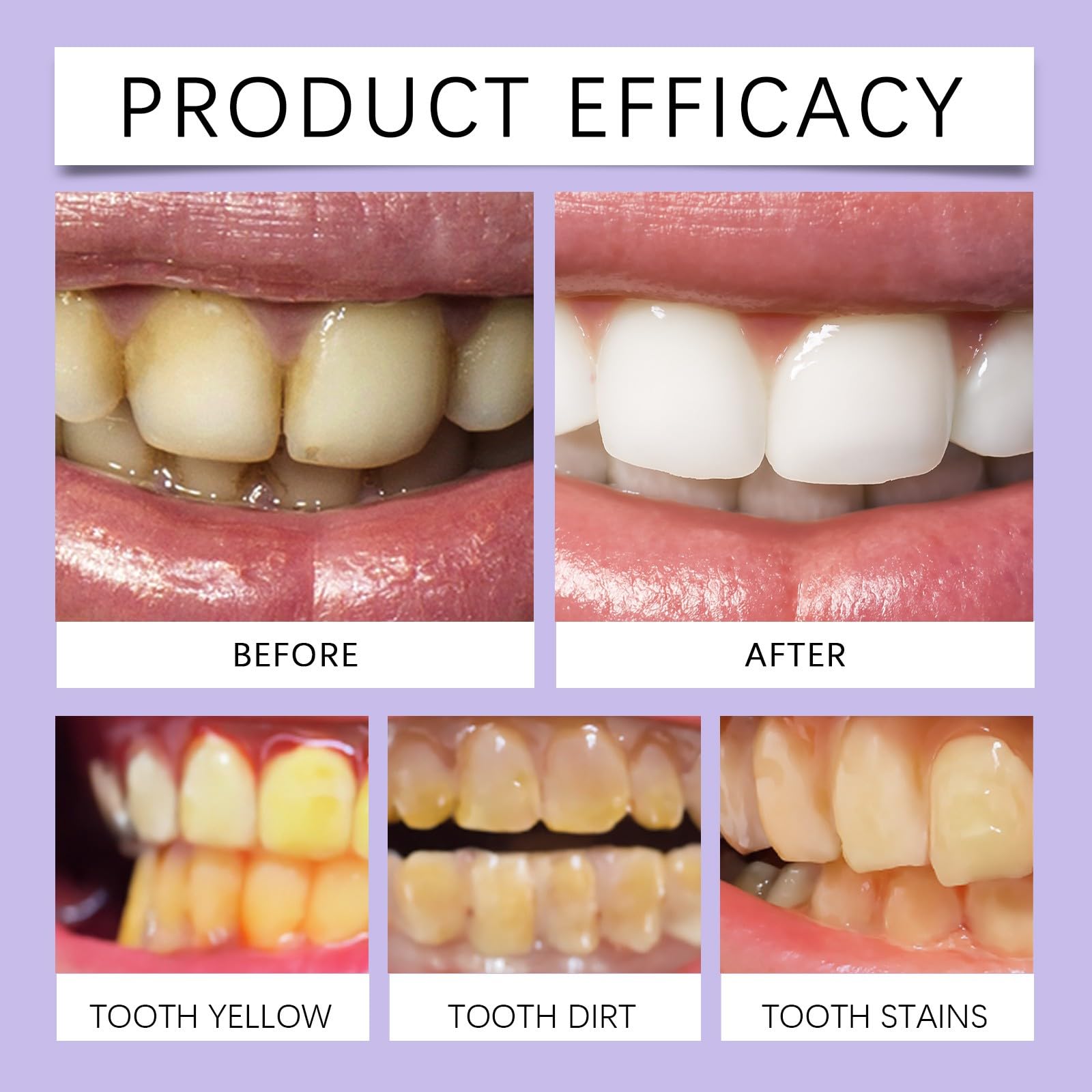 Colágeno Tooth en Polvo, Pasta Dental en Polvo con Colágeno e Hidroxiapatita, 50G, Cuidado de Encías, Protección del Esmalte y Limpieza Suave Diaria, Frescura y Limpieza Natural (2PC) — view 8