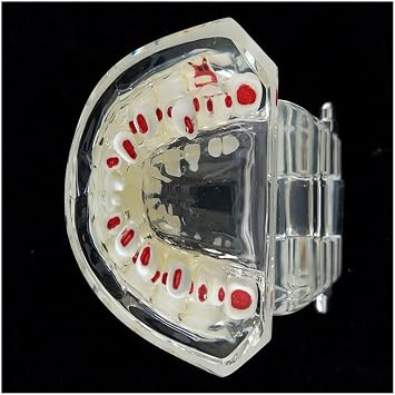 Alternate Primary and Permanent Teeth Model Deciduous Tooth Model for Hospital Teaching Sturding, Teeth Pathological Teaching Model