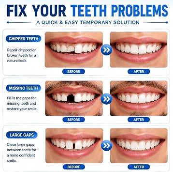 Sukh 10.9oz Moldable False Teeth Beads - Tooth Repair Kit,Repair Thermoplastic Beads,Plastic Pellets for DIY Tooth Filling,Halloween Vampire Teeth Fangs Ideal for Chipped, Cracked