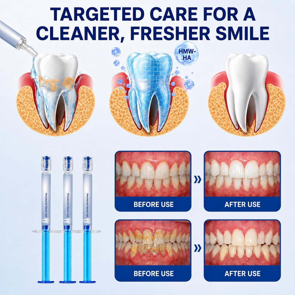 Gum Revive Periodontal Repair Gel, Professional Teeth Gel, Gum Repair Dental Gels, Gentle Daily Mouth Care, Alcohol & Peroxide Free, Fresh Mint Flavor, Color Correcting, Natural Plant Extract