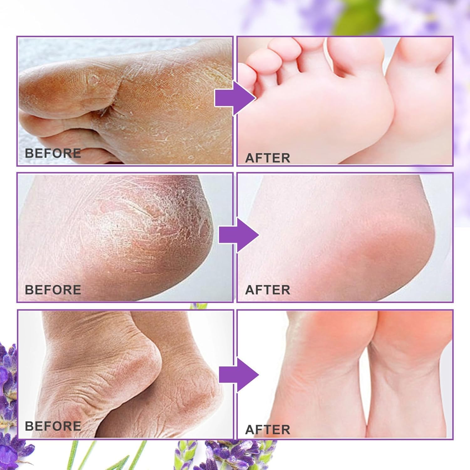 KANISYA Foot Peel Mask Moisturizing Foot Hydration Socks for dry and rough feet Peeling Mask for Cracked Feet, Dead Skin Remover, Rough Heel Repair, Lavender Exfoliant Crack Socks (1 Pairs) 3