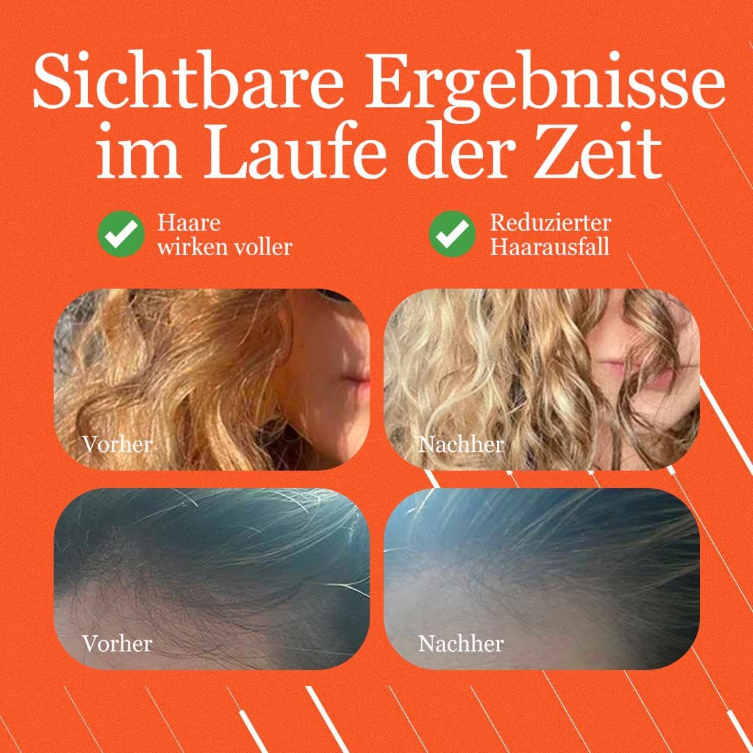 Tricostrong® Anti-Haarausfall Lotion mit Bimatoprost & Tricofactor Growth CPX® | Unterstützt Haarwachstum & Dichte | Stärkt Kopfhaut & Haarwurzeln | Für Frauen & Männer | 100 ml