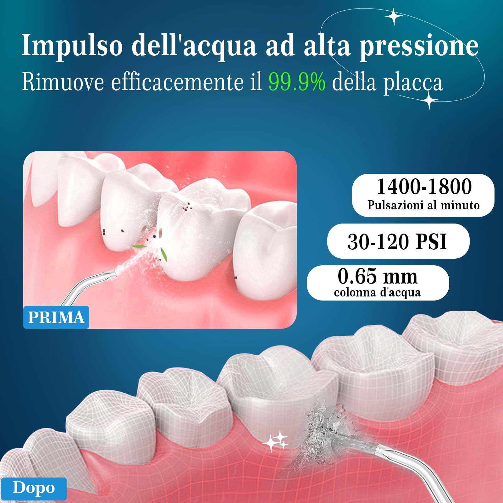 SURFOU Idropulsore Dentale Portatile 3 Modalità 5 Pressione dell'acqua e 7 Ugelli, 230 ml IPX7 Impermeabile USB Ricaricabile per Viaggi e uso Domestico