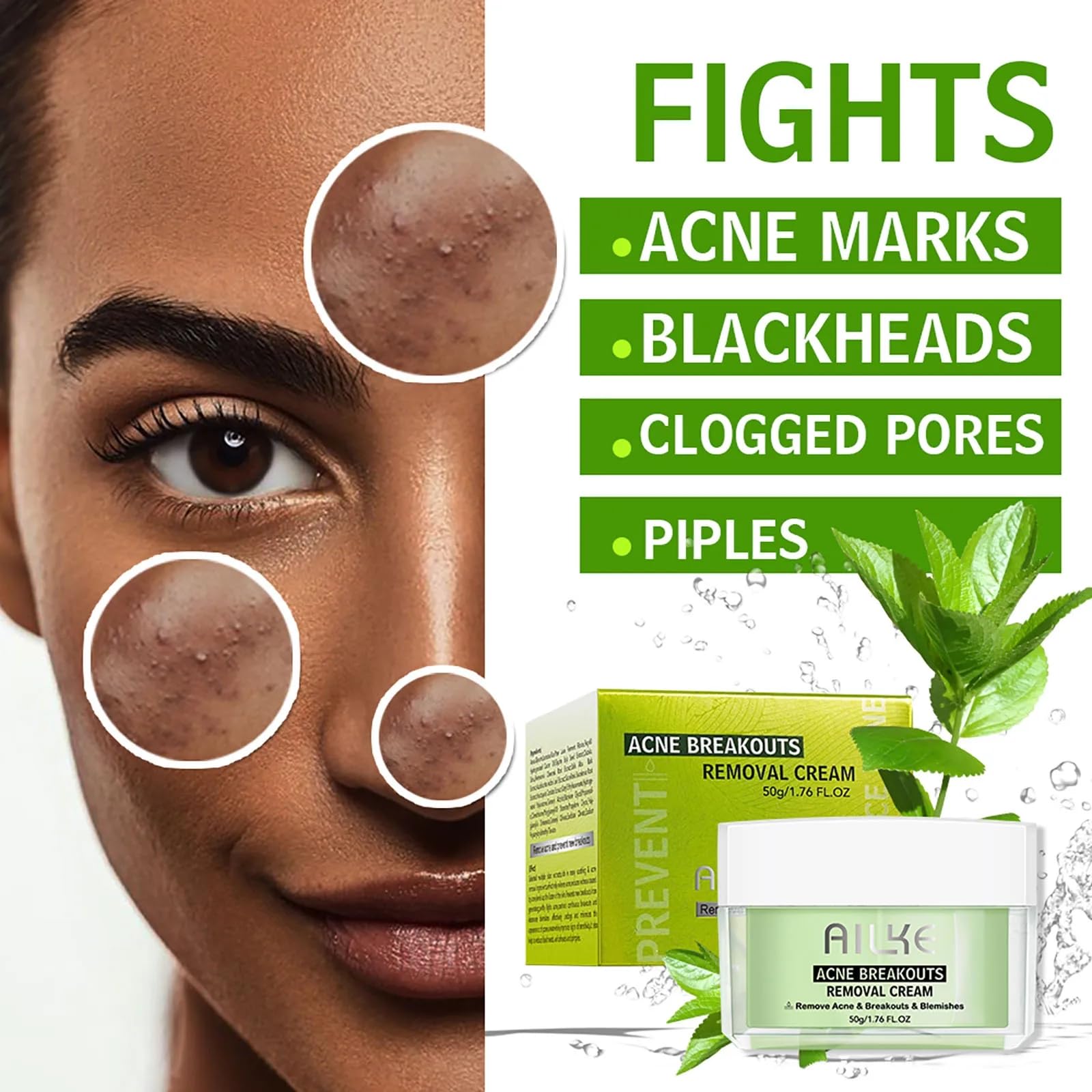 AILKE Salicylic acid Acne Removal Cream, Effectively Anti Acne-prone Skin, Control Breakouts, Reduce Blemishes, Unclog Pores, Repair Post-Acne Marks. All Natural (BREAKOUT CONTROL ACNE 3 in 1 SET)