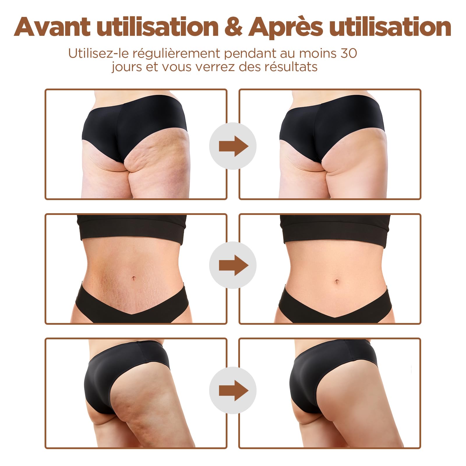 MYCARBON Masseur Anti Cellulite à Ventouse Électrique Palper-rouler Automatique Appareil Massage Infrarouge Minceur Aspiration Liposuccion Raffermissement pour Visage, Ventre, Cuisses, Bras, Jambes