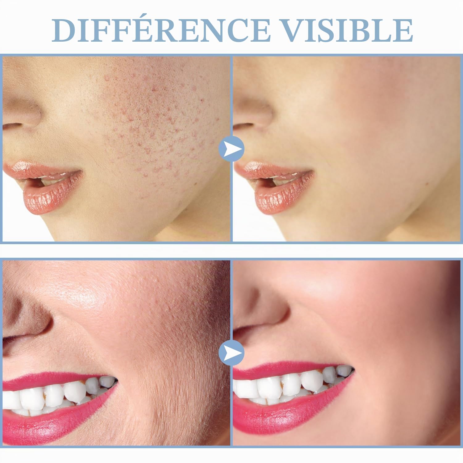 Appareil Haute Frequence Esthetique - TUMAKOU Appareil Visage Avec 4 Electrodes pour Soins pour le Visage - Pour l'acné, le Raffermissement et les Rides | Avec 4 Electrodes pour Soins pour le Visage - Pour l'acné, le Raffermissement et les Rides