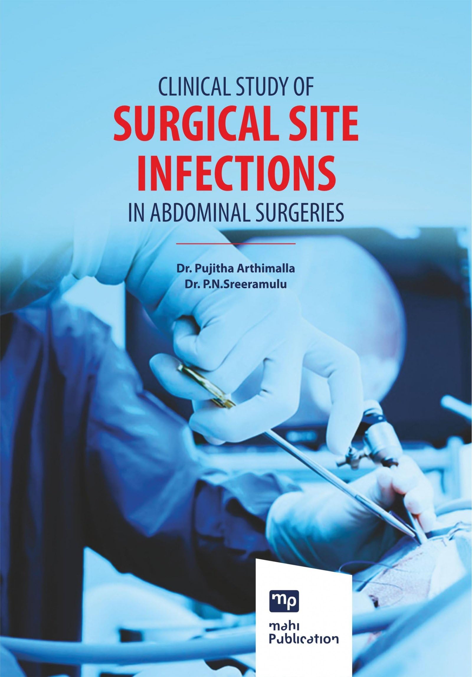 Buy Clinical Study of Surgical Site Infections in Abdominal