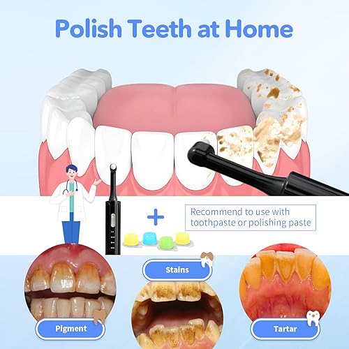 Miniatura 6 de Pulidor de dientes eléctrico, removedor de placa para blanquear los dientes, kits de pulido de dientes 4 modos de velocidad, pulidor dental