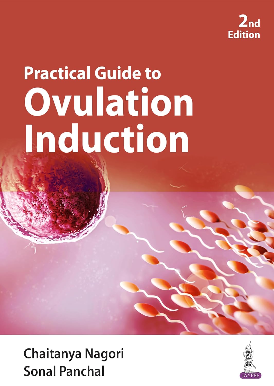 Practical Guide to Ovulation Induction      [Print Replica] Kindle Edition