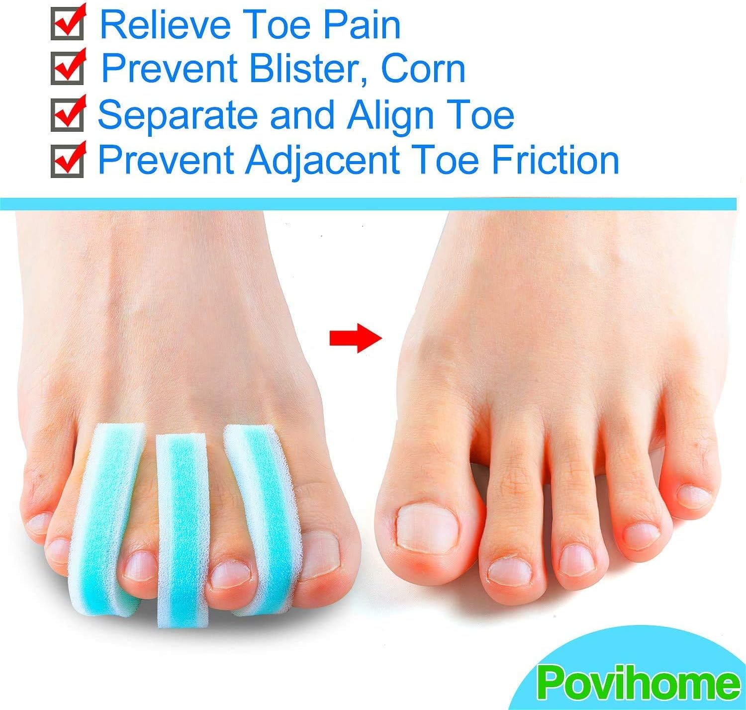 Povihome 10 Pack Foam Toe Spacers(2/5" Thick), 3-Layer Toe Separators - Large Size - to Align Crooked, Overlapping Toe, Relieve Corn, Blister and Reduce Irritation