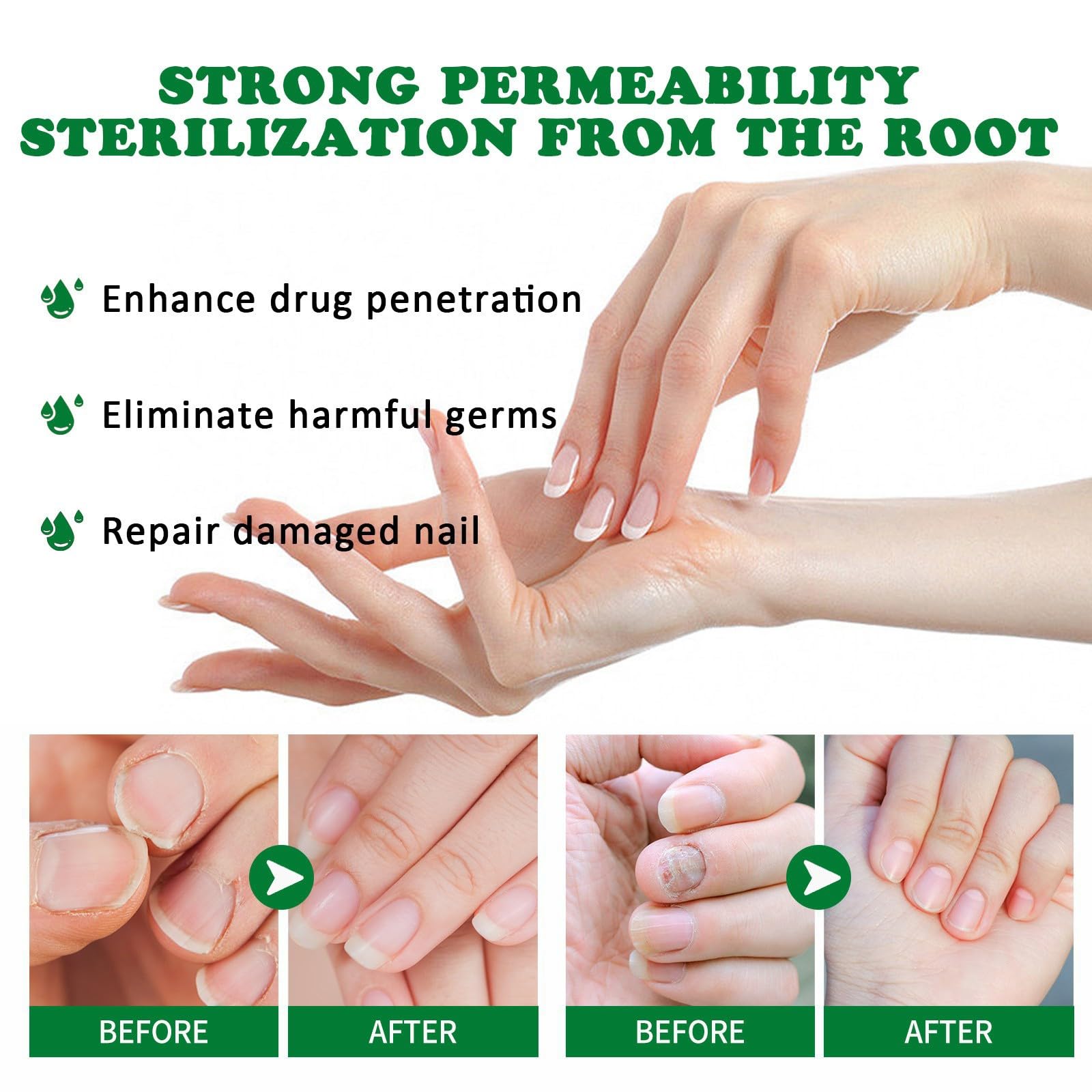 Nail Fungus Treatment for Toenail, 7 Days Nail Fungus Treatment Ginger Nail Fungus Treatment for Toenail Nail Nutrient Strengthener Ginger Nail Growth Oil for Natural Shine - Image 3