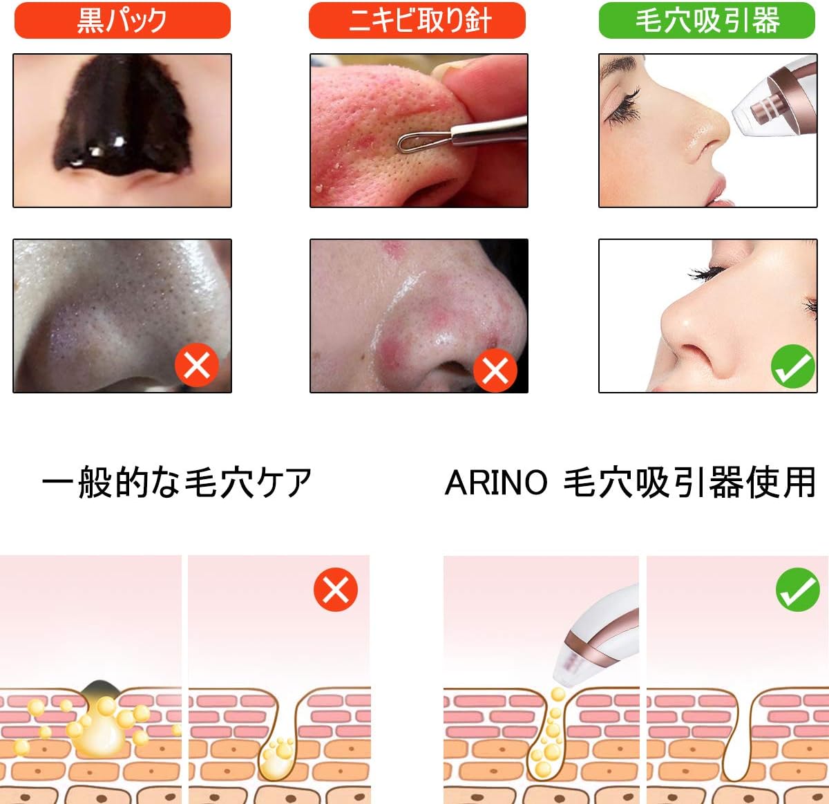 Arino 毛穴吸引器 スポットクリア 毛穴クリーナー クリーン イチゴ鼻 黒ずみ ニキビ 角栓 除去 フェイスケア スキンケア 皮脂 しわ 皮膚改善 引き締め ディープクレンジング 美顔器 4種類吸引ヘッド付き 3段階吸引力調節 充電式 男女兼用 Arino Amazon