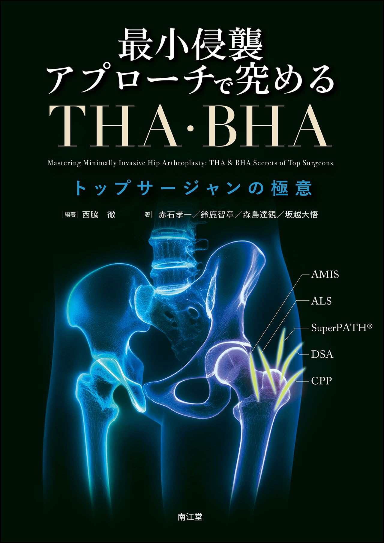 最小侵襲アプローチで究めるTHA・BHA = Mastering Minima… 最小侵襲アプローチで究めるTHA・BHA: トップサージャンの極意 | 西脇