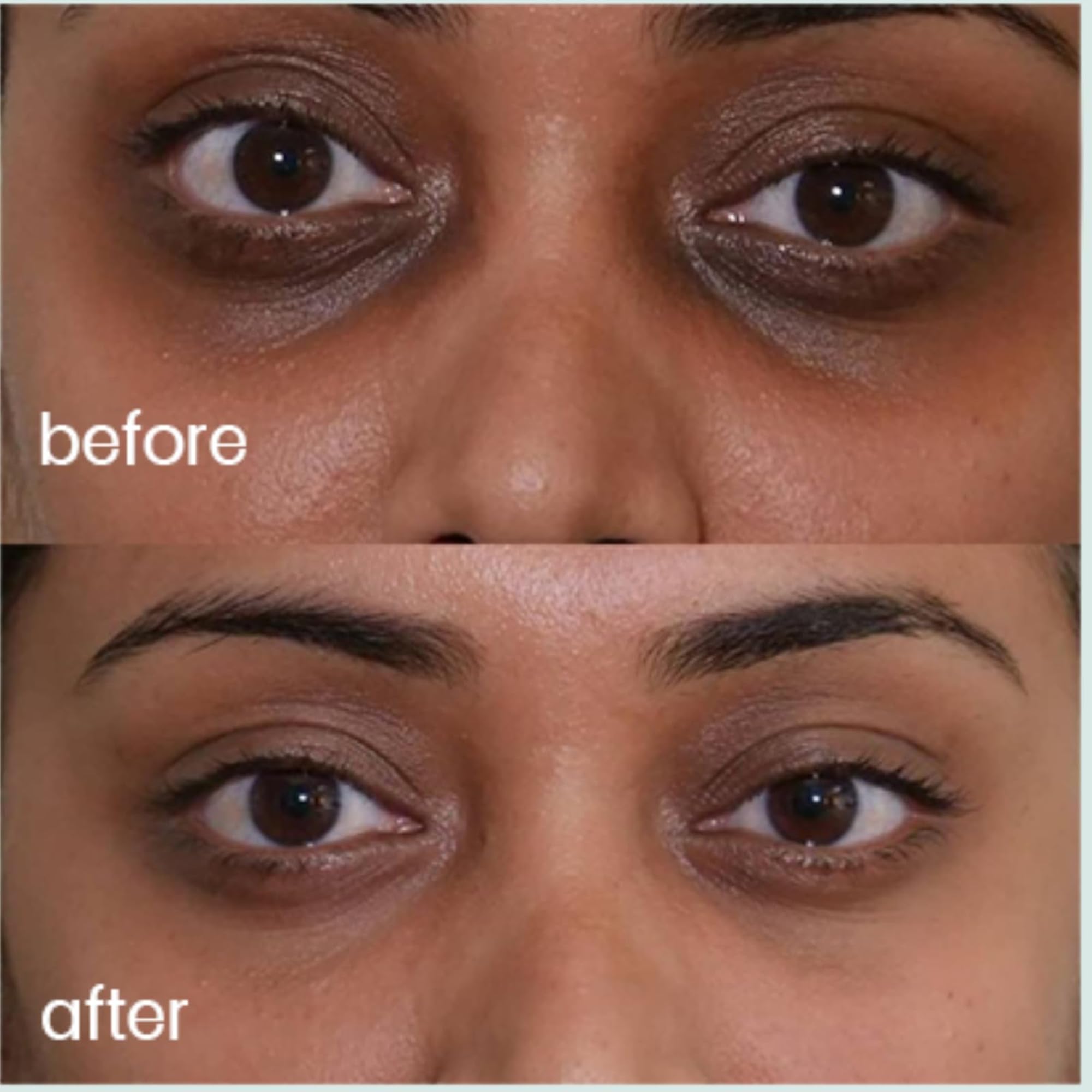Under Eye Cream for Dark Circles I 5% Peptides, 4% Caffeine & 3% Bakuchiol | Reduces Puffiness & Fine Lines | Eye Serum for Men & Women — Amazon image 5
