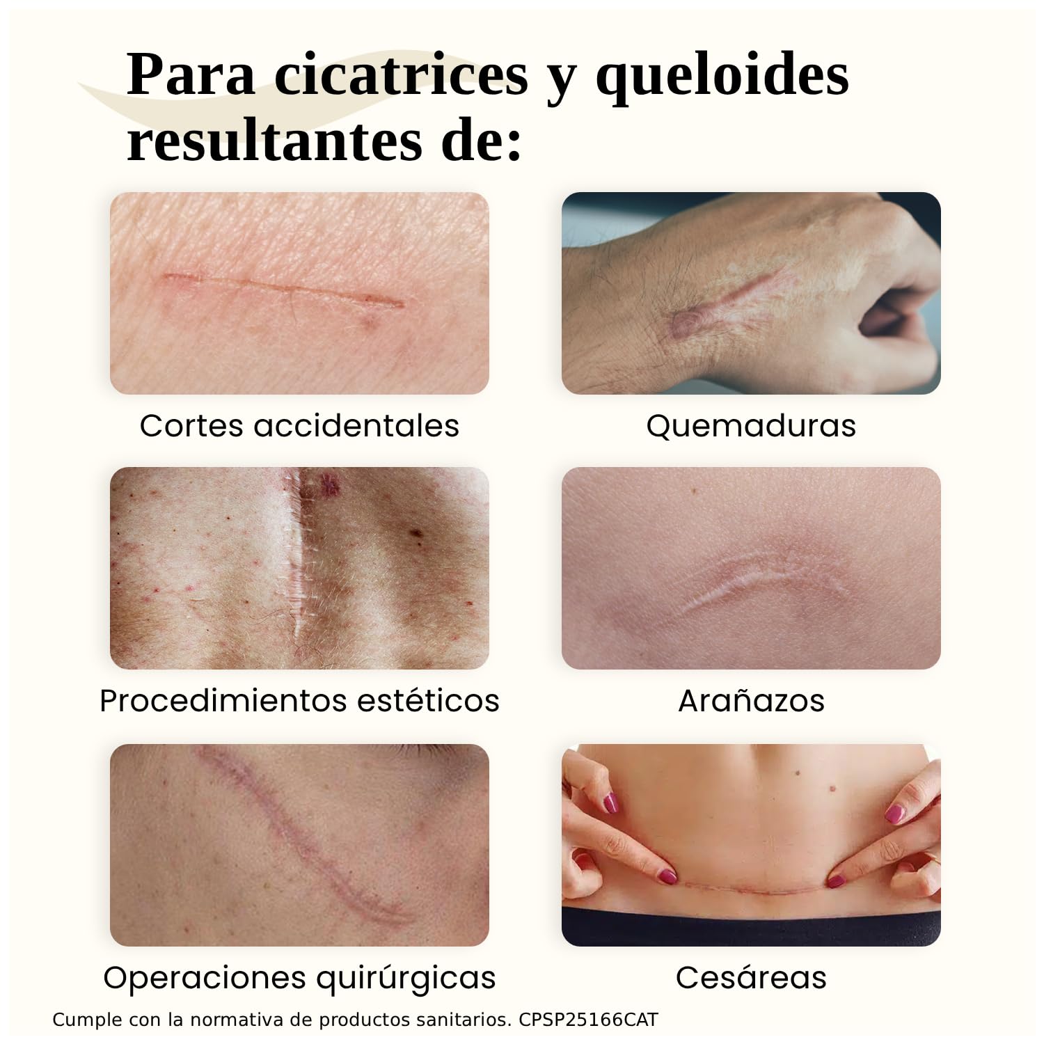 Dermatix Gel para Tratamiento de Cicatrices – Reduce, Previene y Suaviza el Aspecto de Cicatrices y Queloides, Quemaduras, Cesáreas y Cortes – 15g