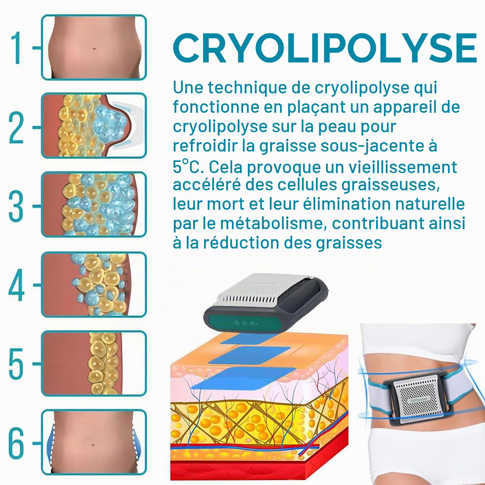 CongéLateur De Graisse Domestique, Machine De Remodelage Corporel par Cryolipolyse, Minuterie 30min/60min, BrûLeur De Graisse Abdominale, pour Abdomen, Bras, Cuisses, pour Hommes Et Femmes