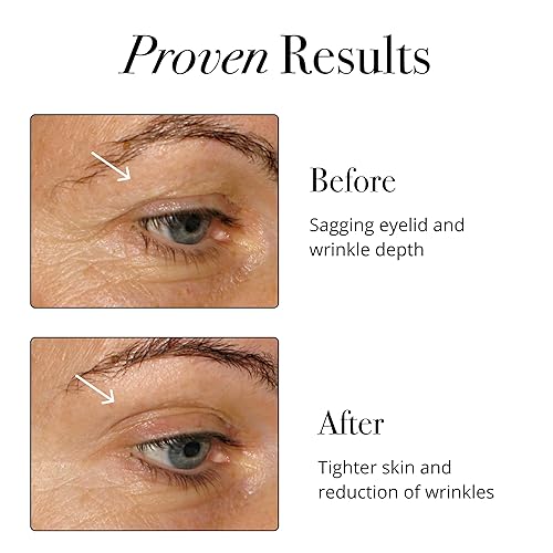 Miniatura 2 de Glotrition Collagen Peptide - Mezcla para bebidas, 7,6 ml