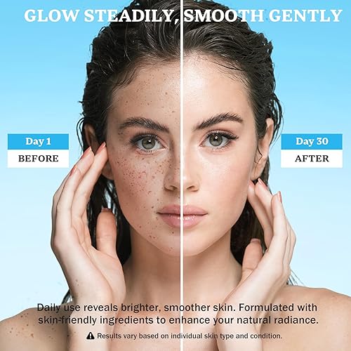 Miniatura 3 de Eliminador de manchas oscuras para rostro y cuerpo crema corrector de manchas oscuras, melasma, pecas, manchas solares, removedor de manchas de la