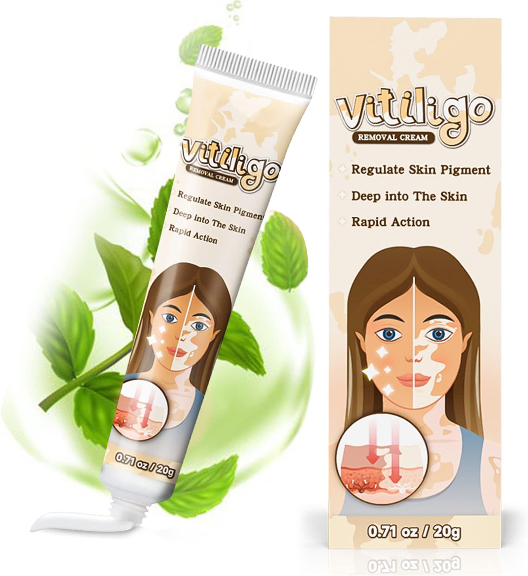 Supwell Vitiligo Cream, Vitiligo Treatment for Skin Vitiligo, Vitiligo Care Cream for Reduce White Spots and Improve Skin Pigmentation