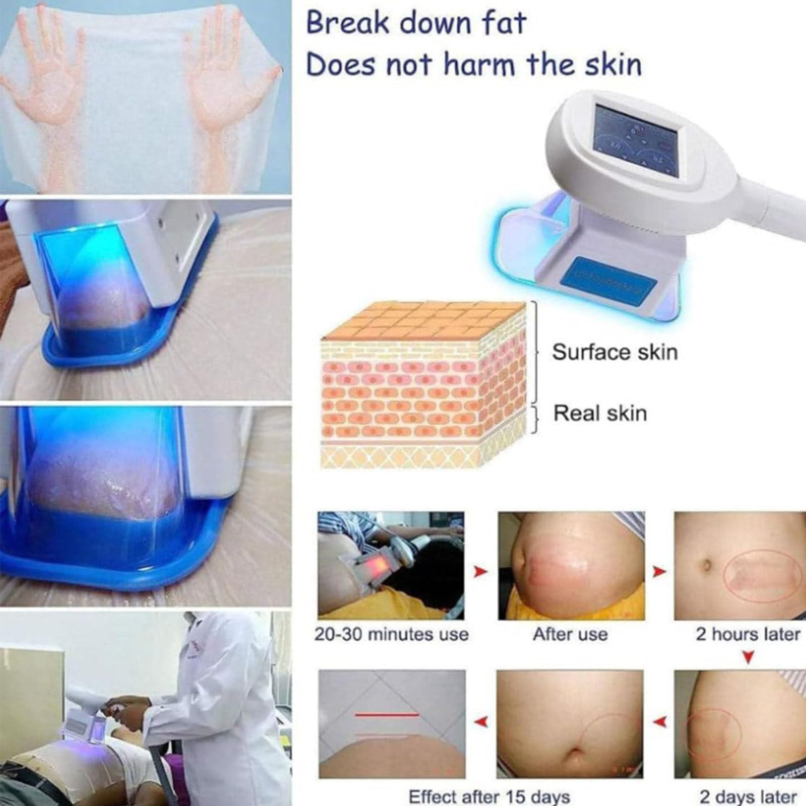 Macchina Dimagrante per Criolipolisi,con 3 Maniglie,Macchina Dimagrante per Congelamento,Massaggiatore per La Rimozione della Cellulite,Modellamento del Corpo per Braccia,Vita