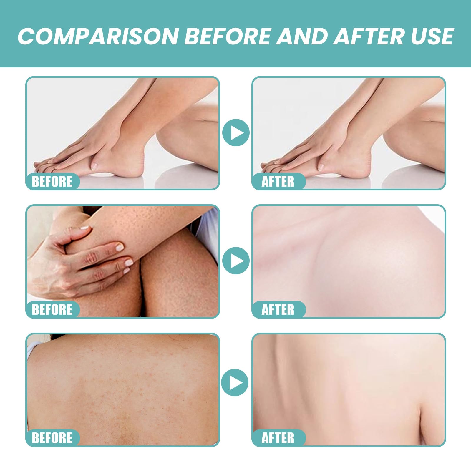 Acidified Original Skin Bath Oil So Soft Original Skin Bath Oil So Soft, oryginalny olejek do kąpieli, miękki, miękki, oryginalny olejek do kąpieli, wygładza i zmiękcza suchą lub szorstką skórę