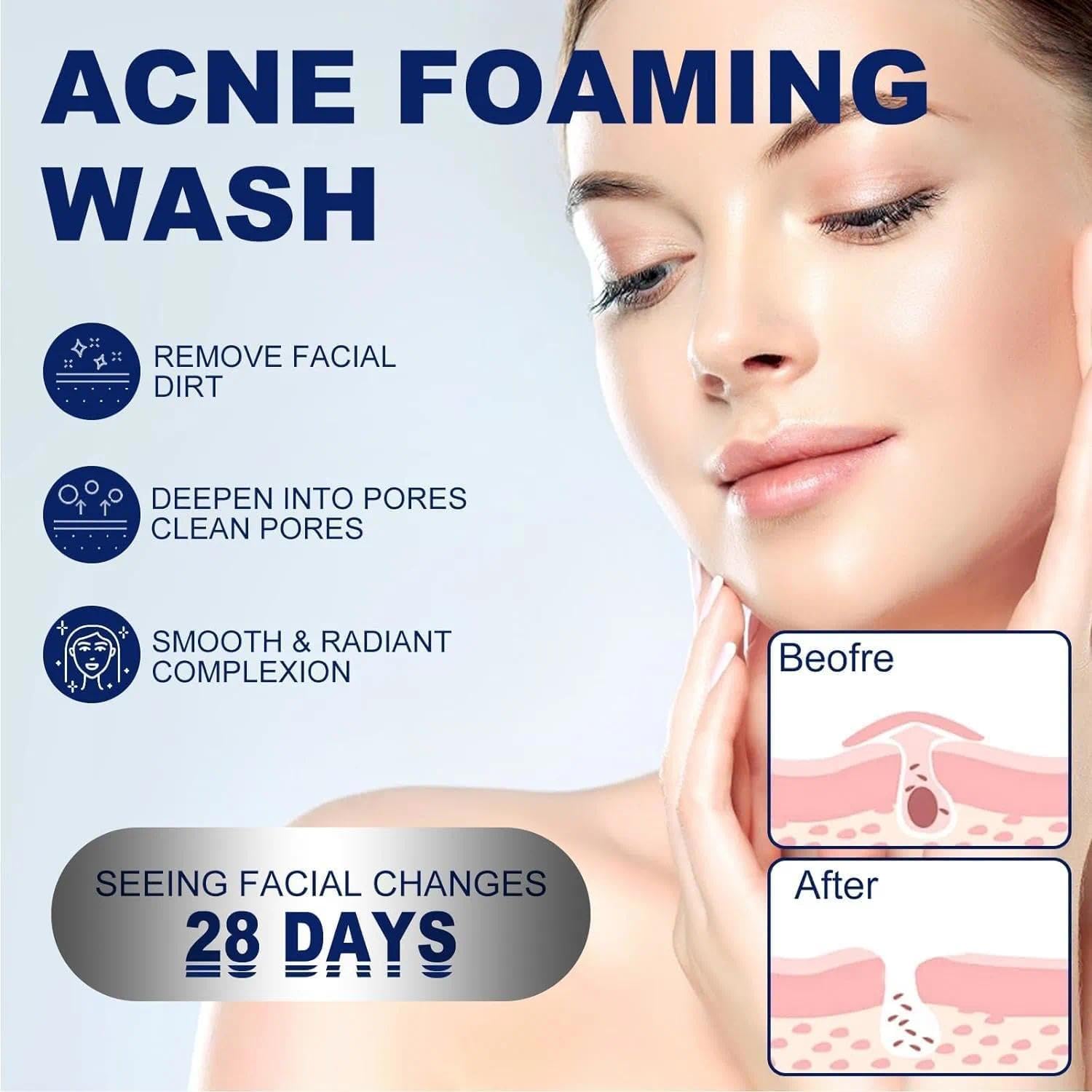 4% Acne Gentle Hydrating Face Cleanser for Women Sensitive Face Wash with Hyaluronic Acid - Image 4
