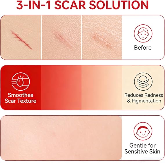 Scar Soothing Cream & Smoothing Cream for Scars - Gentle Care for Sensitive Skin, Helps Improve Appearance of Scars, Reduces Redness, Lightweight Non-Greasy Formula(2 PCS)