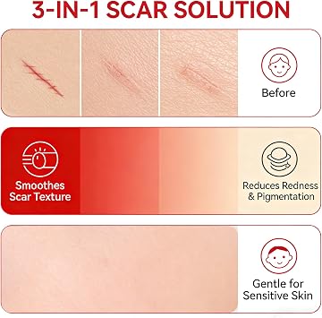Scar Soothing Cream & Smoothing Cream for Scars - Gentle Care for Sensitive Skin, Helps Improve Appearance of Scars, Reduces Redness, Lightweight Non-Greasy Formula(2 PCS)