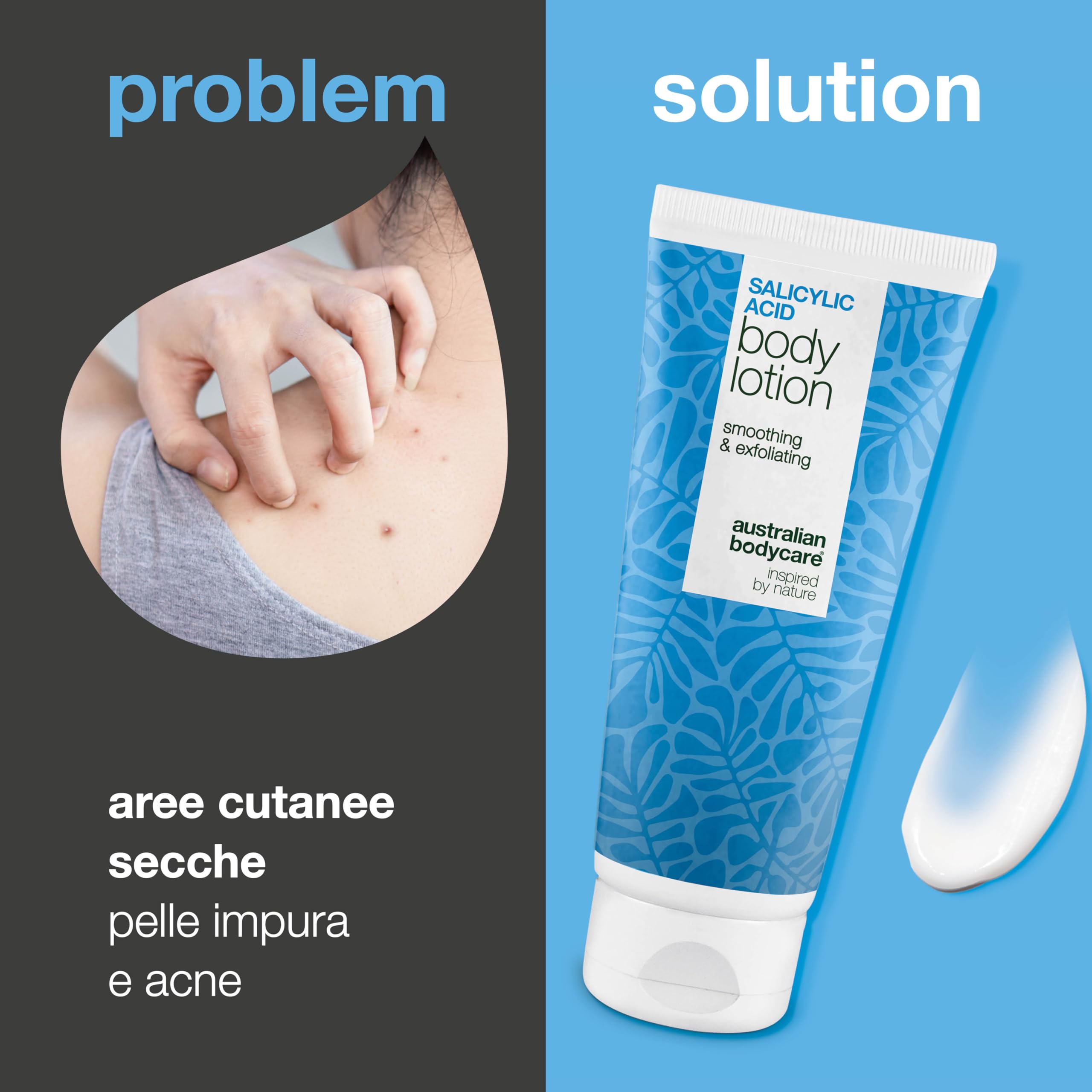 Lozione corpo con acido salicilico (200 ml) – per imperfezioni, pelle secca e grassa. Con BHA, niacinamide e acido ialuronico per esfoliare e idratare