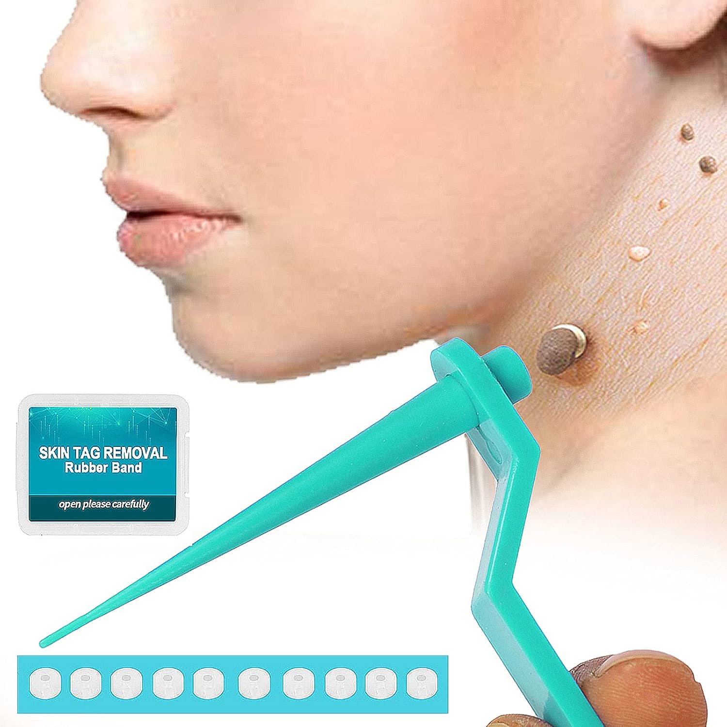 Micro Skin Tag Remover, Skin Tag Removal Tool Skin Tag Removal Device