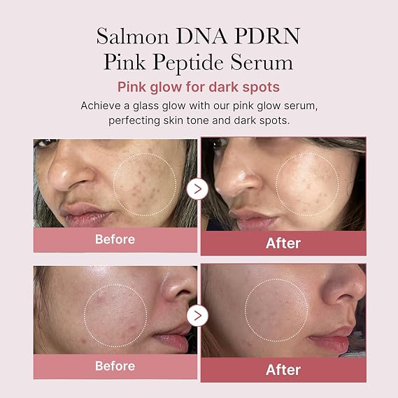 medicube PDRN Plump Care Duo: Age-R Booster Pro Black and Salmon DNA PDRN Peptide Serum | At-Home Care