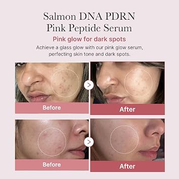 medicube PDRN Plump Care Duo: Age-R Booster Pro Black and Salmon DNA PDRN Peptide Serum | At-Home Care