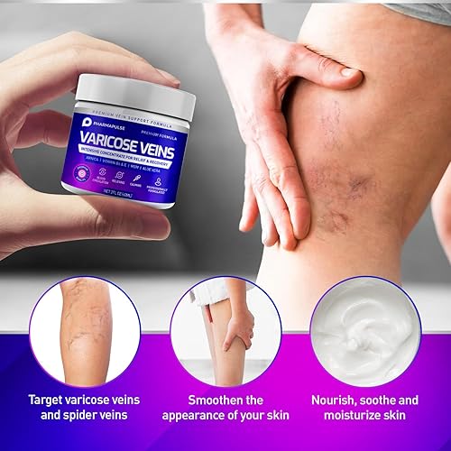 Miniatura 3 de Crema de venas varicosas venas varicosas y crema calmante para piernas tratamiento natural de venas varicosas y arañas vasculares fortalece la salud