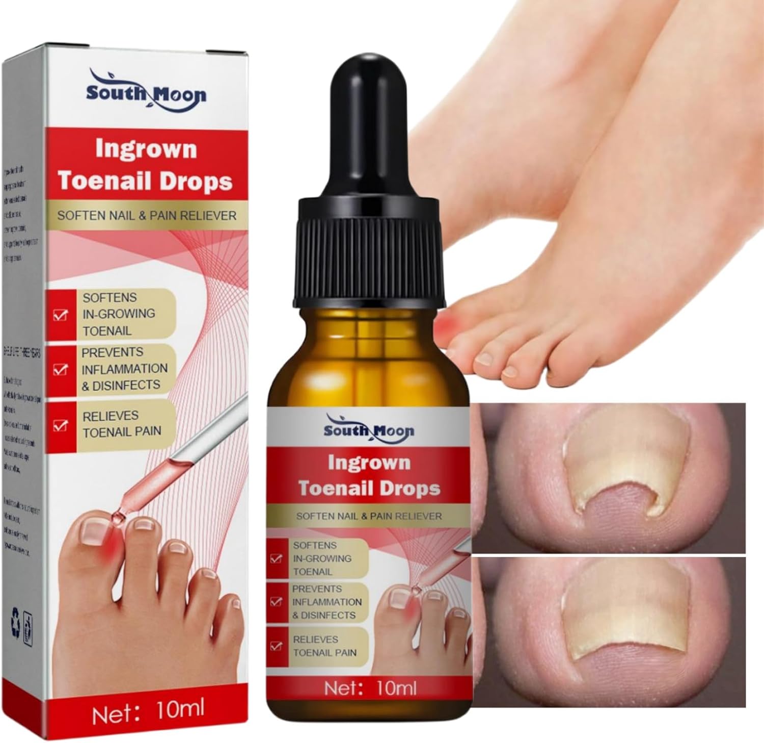 Ingrown Toenail Treatment Drop,Cuticle Care Oils for Ingrown Toenails