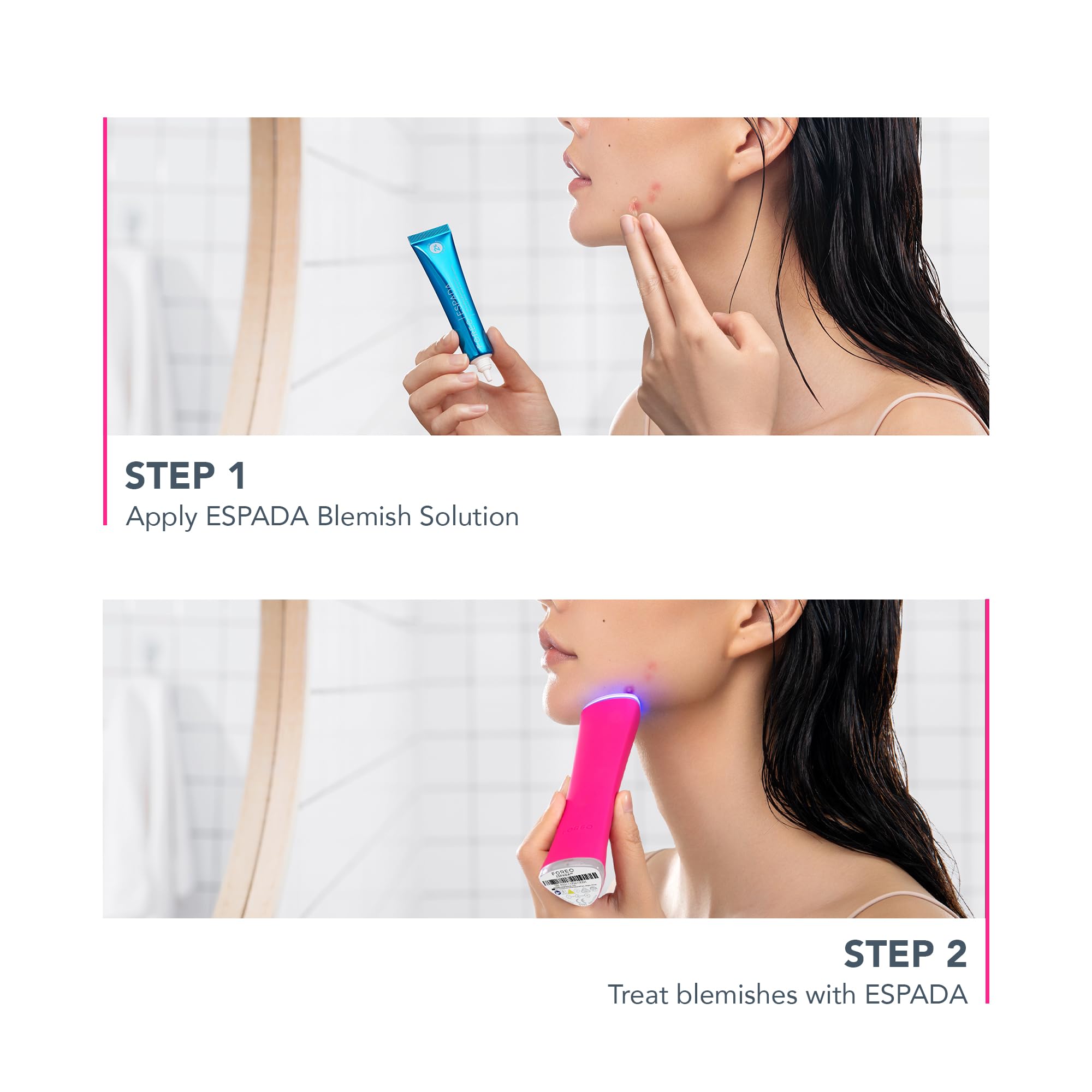 Amazon.com: FOREO ESPADA 2 LED Light Device - Blemish Treatment
