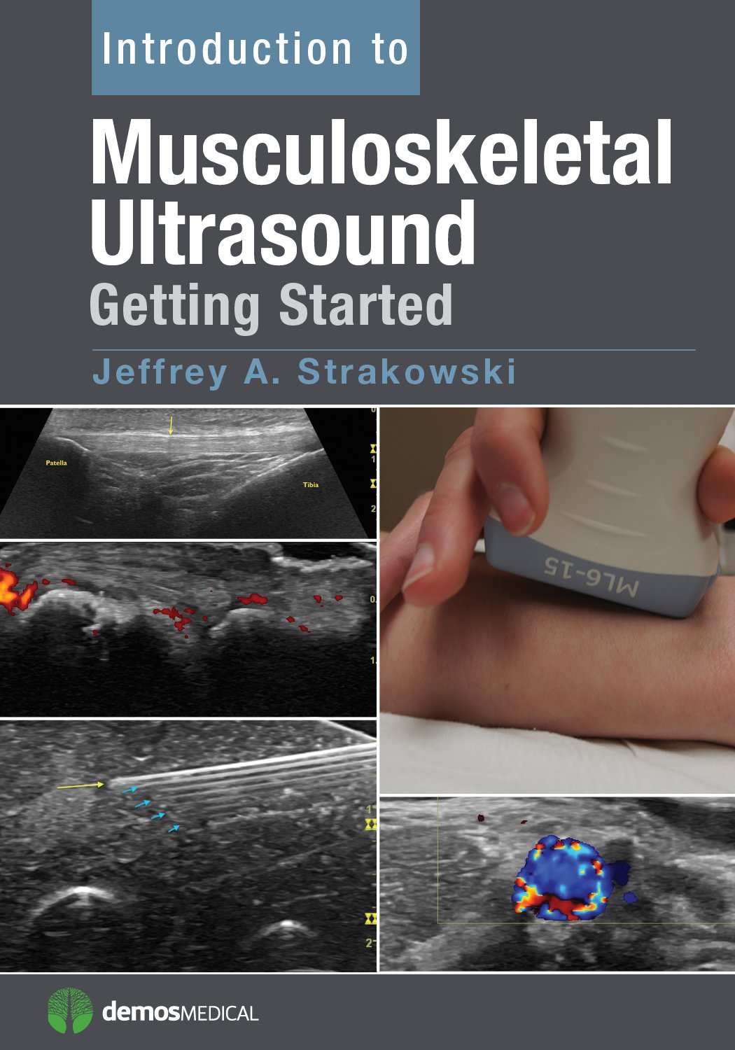 Introduction to Musculoskeletal Ultrasound: Getting Started      1st Edition, Kindle Edition
