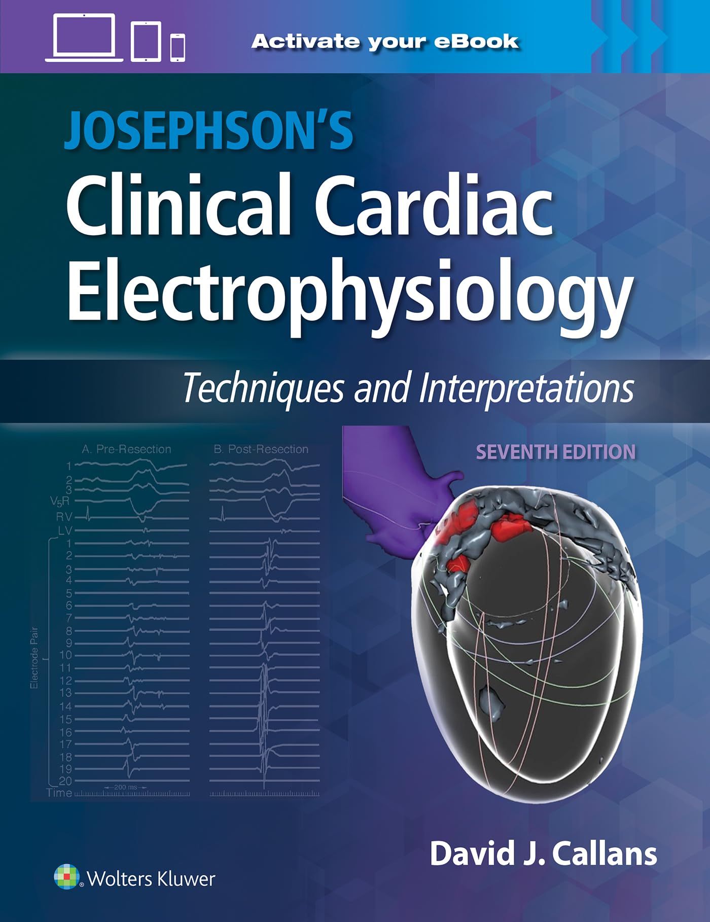 Josephson's Clinical Cardiac Electrophysiology: Techniques and Interpretations Hardcover – 4 Jan. 2024