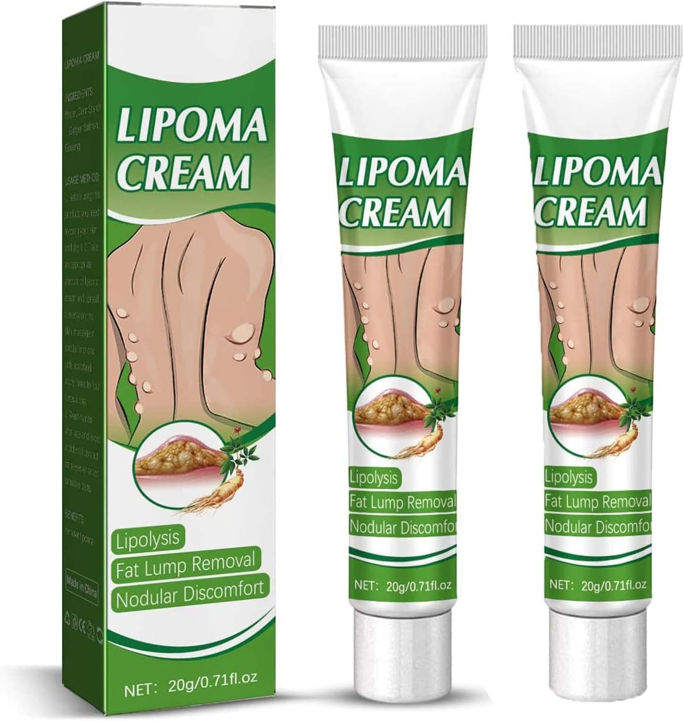 LipomaCure Soothing Ointment, LumpFree Lipoma Removal Cream, Herbal Lipoma Lumps Removal Cream, Get Rid of Your Fatty Lipoma Lumps (2PC)