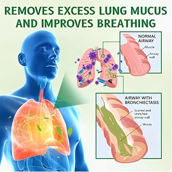Lung Cleansing Spray, Advanced Herbal Lung Cleansing Spray (1)