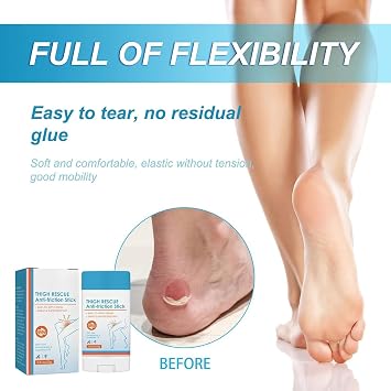 Dermaunder Anti Friction Stick,Dermaunder Friction Stick,𝐀nti Chafing Cream,Anti Chafe Stic𝐤,𝐀nti Chafe Balm,A𝐧ti Frictio𝐧 Stic𝐤 for Heel,Lower Arm,Thigh,Legs (1)