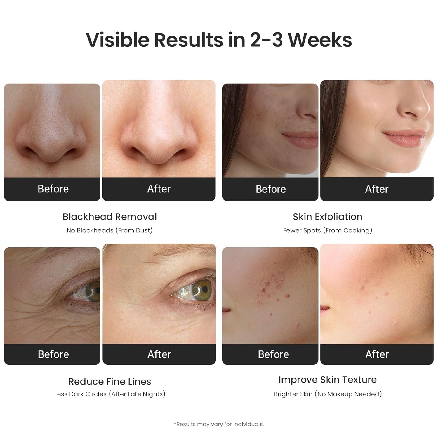 UNOISETION Diamond Microdermabrasion Machine, 0-80Kpa Professional Suction, Durable & Precise Home use Facial Care, Safe & Cost-Effective Salon-Grade Skin Equipment for Busy Womem