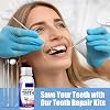 Tooth Filling Repair Kit, Temporary Tooth Repair, Temporary Tooth Filling Repair Kit, Filling Repair Beads for Fixing Missing Teeth, Reusable Fake Teeth Repair Beads for Broken or Missing Teeth